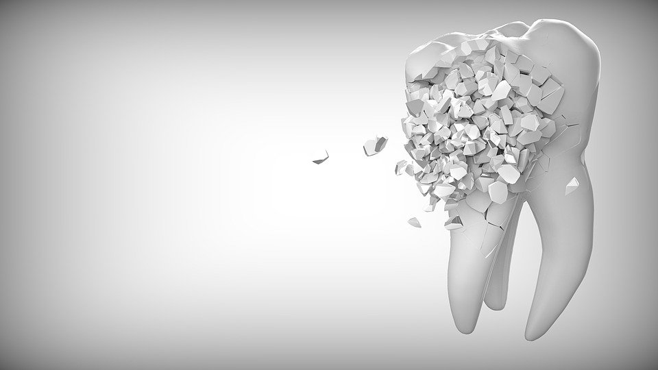 Labāko zobu implantācijas klīniku reitings Maskavā 2020. gadam