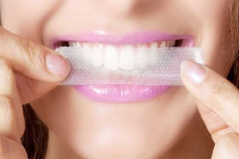 Évaluation des meilleures bandes de blanchiment des dents pour 2020
