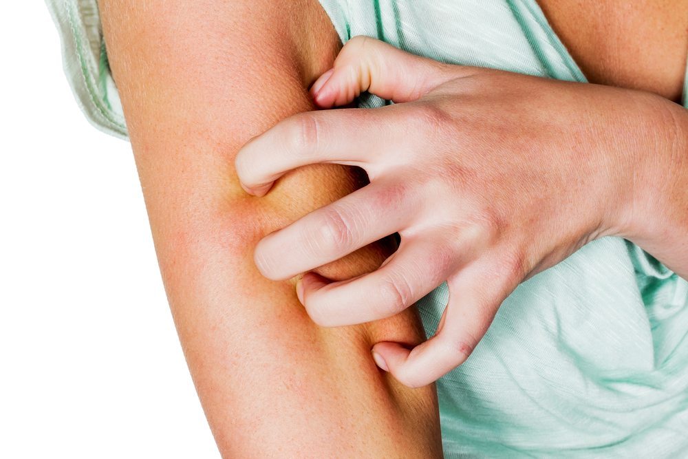 Rating of the best remedies for itchy skin for 2020